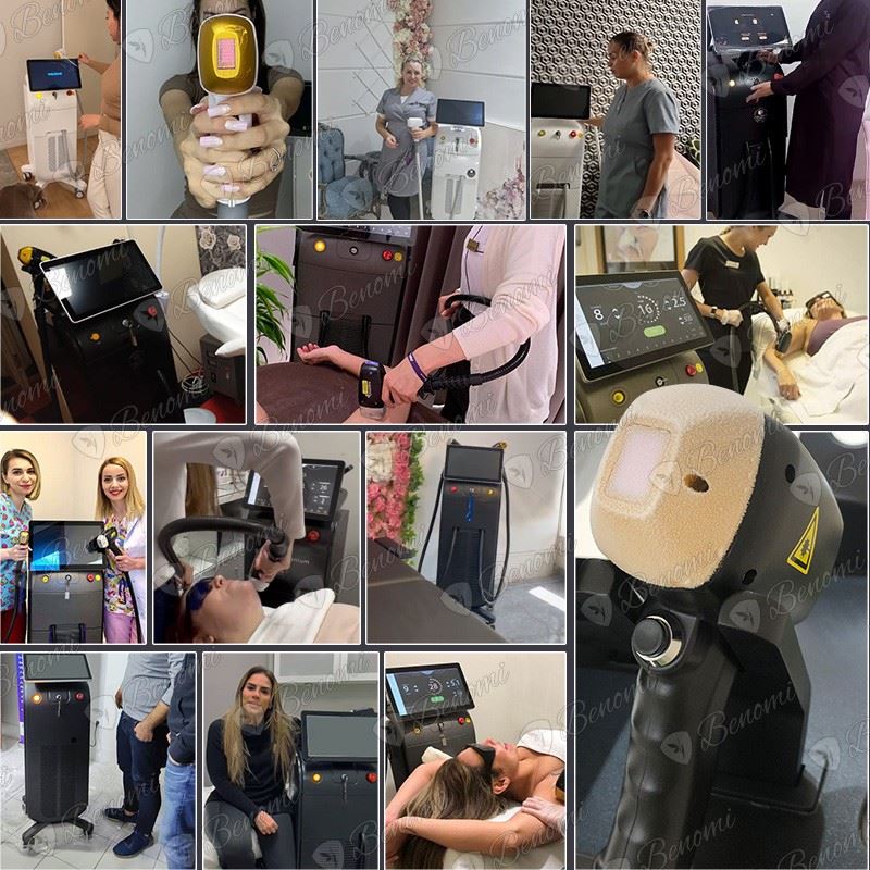 Professional Diode Laser Hair Removal Machine Sale