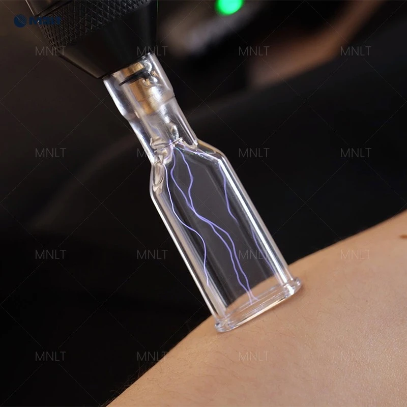 Fusion Plasma – Advanced Skin Rejuvenation & Resurfacing Device best